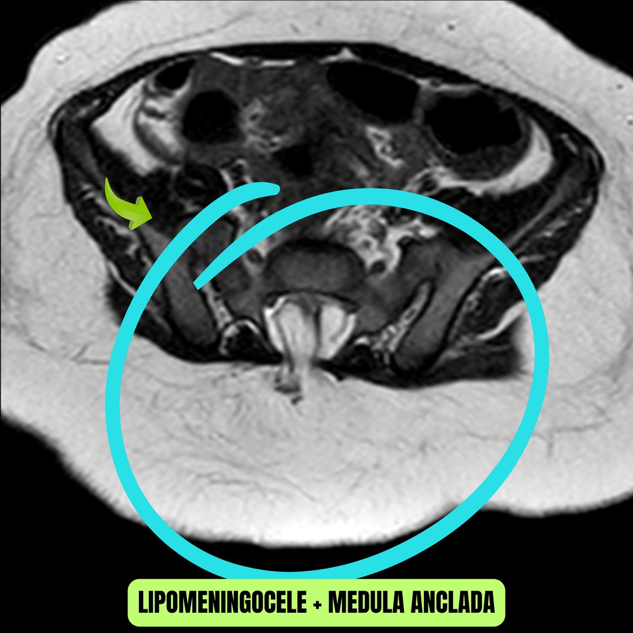David Tafur Muñoz-1647