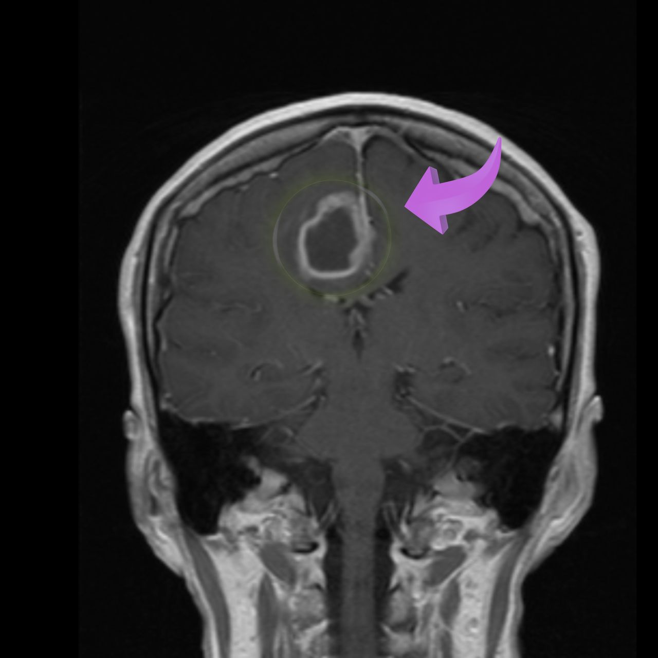 David Tafur Muñoz-2031