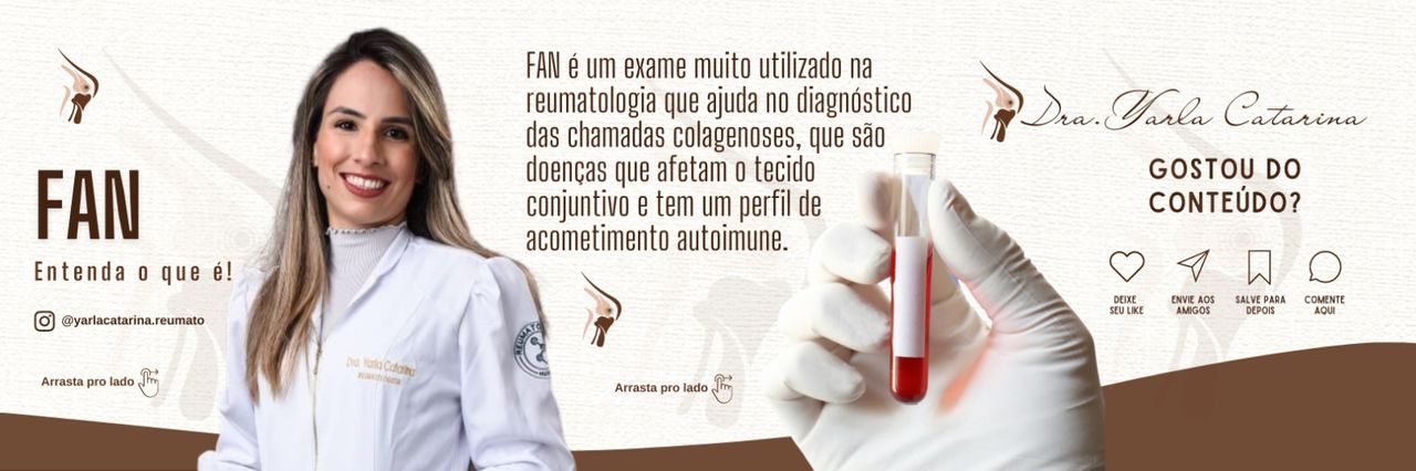 Yarla Catarina Antão De Alencar-4