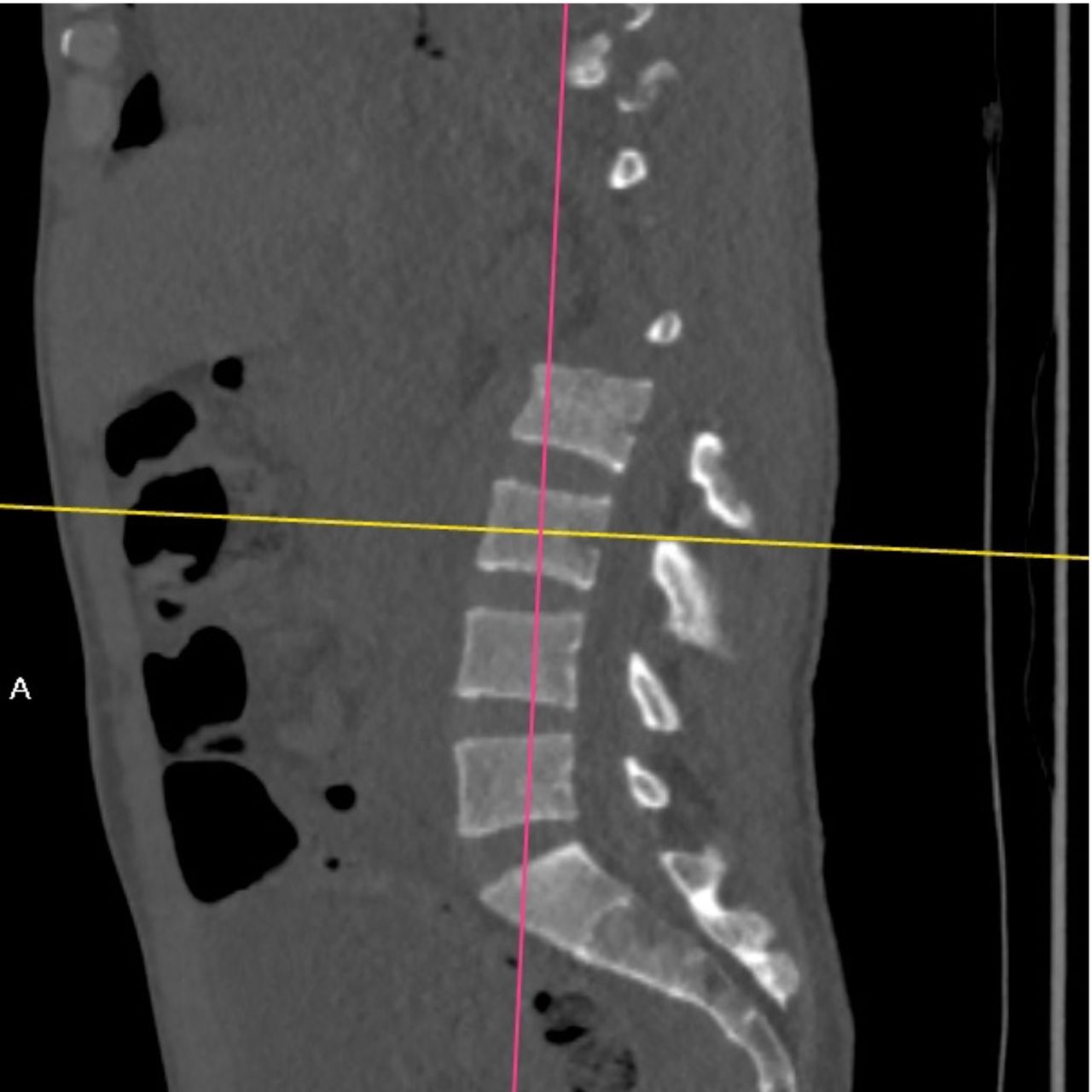 David Tafur Muñoz-1827