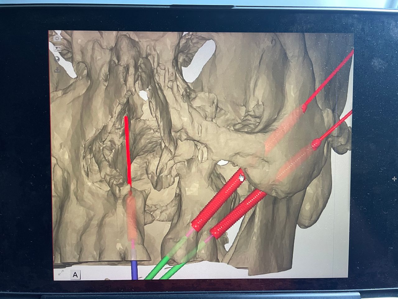 Jose Vicente Rocha Fernandez-42