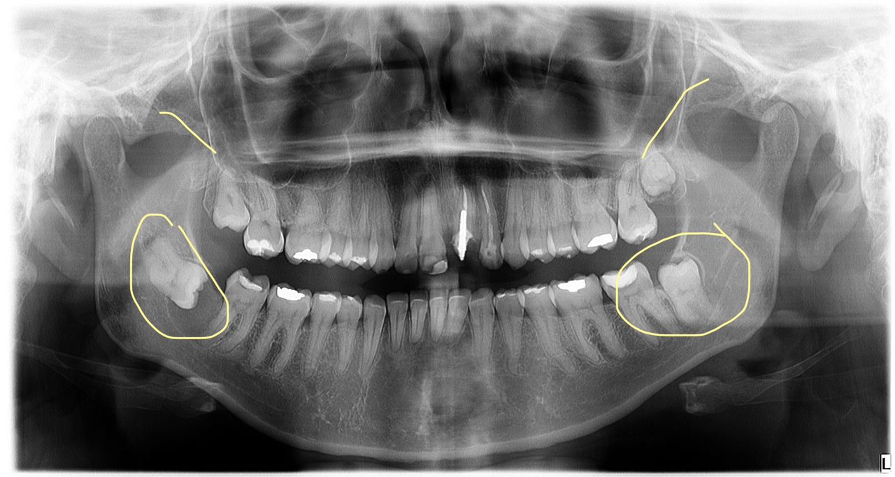 Rafael Meira Pimentel-16