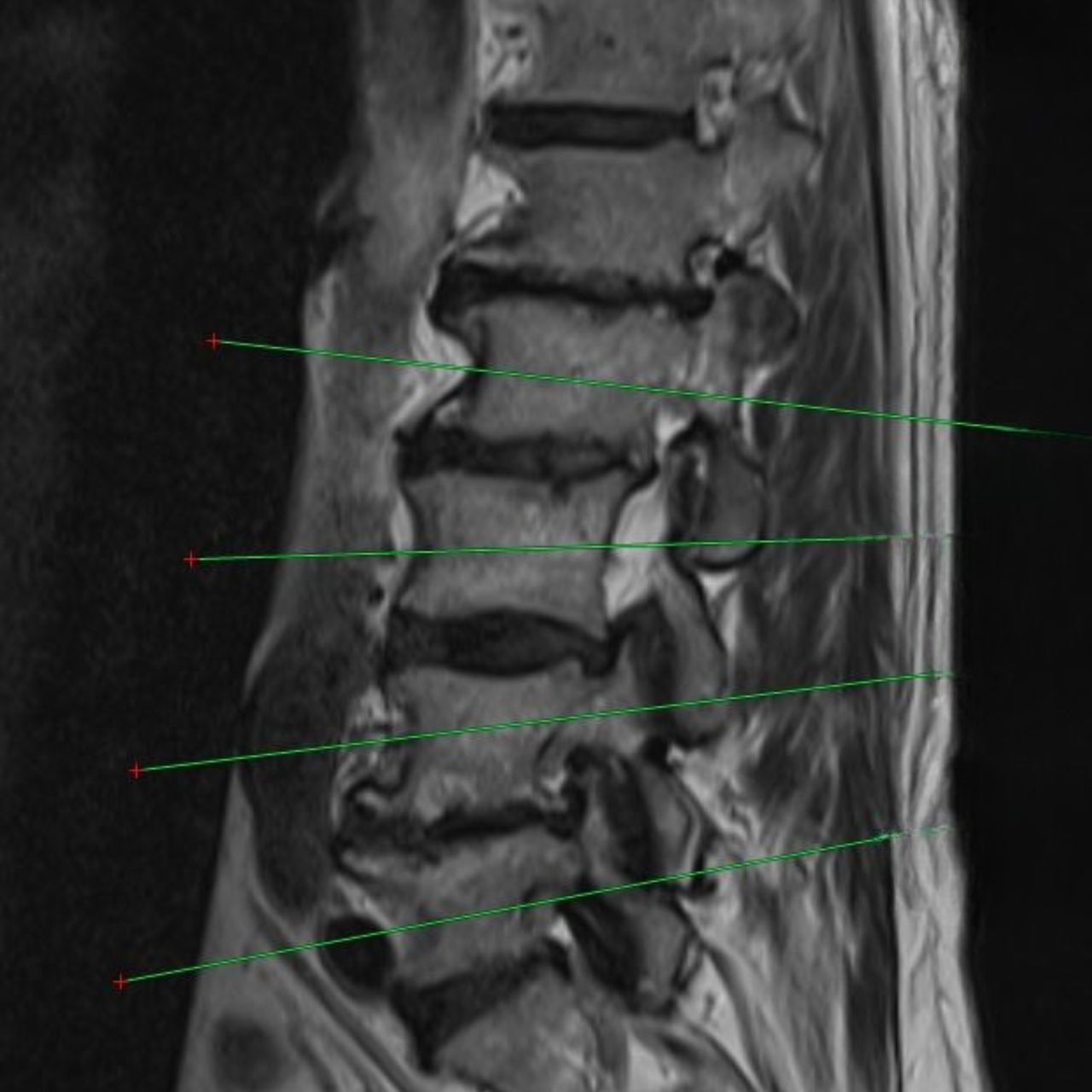 David Tafur Muñoz-1415