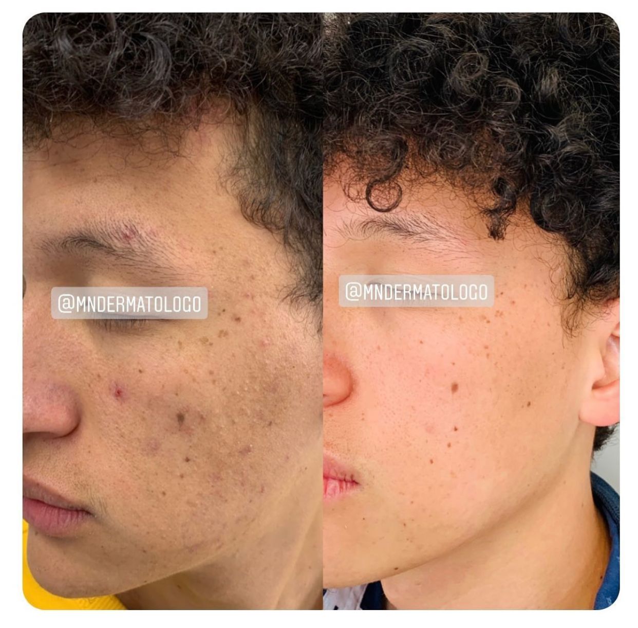 Mario Naranjo Otero-3