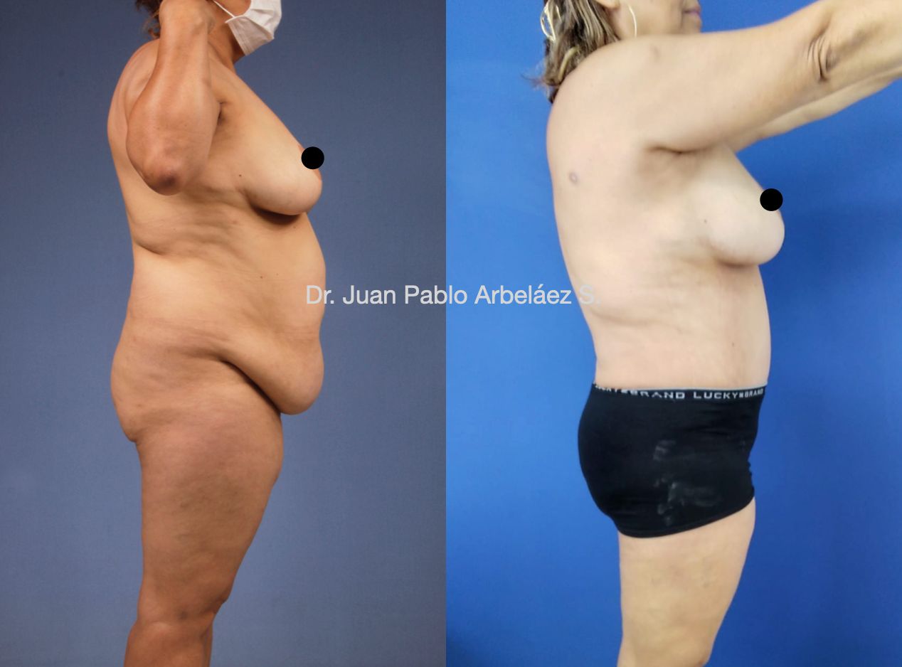 Juan Pablo Arbeláez Sierra-40