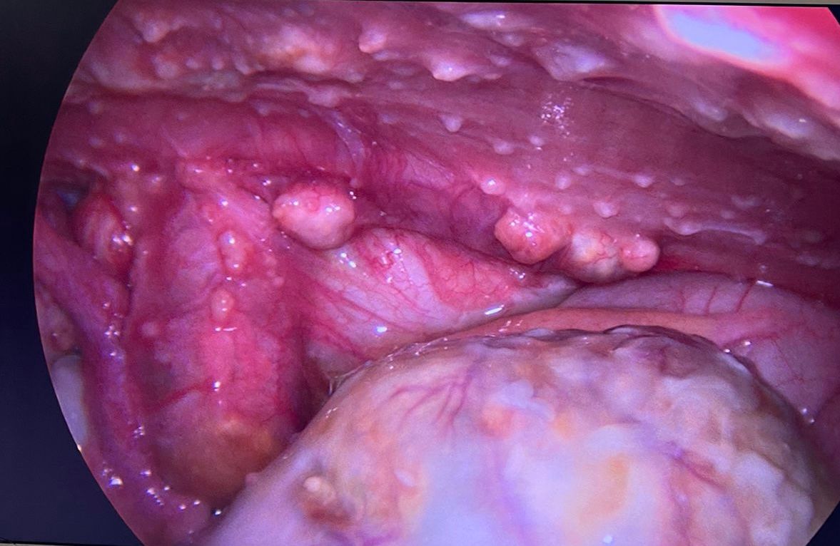 Adalberto Cesario Pereira Junior-58