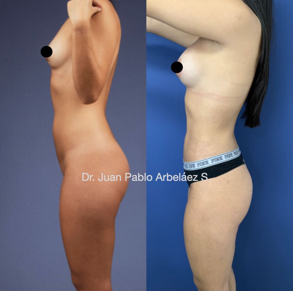 Juan Pablo Arbeláez Sierra-32