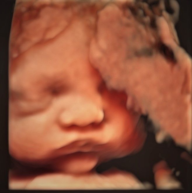 Charles Schwantz De Lima-16