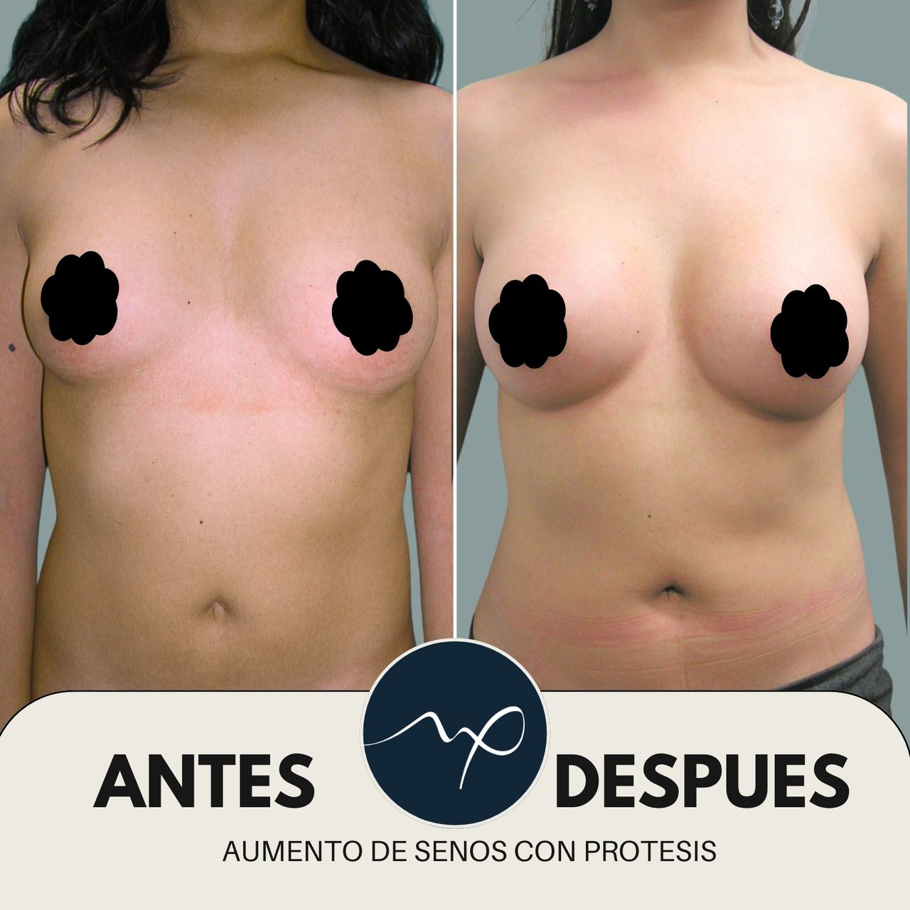 Mauricio Pineda-5
