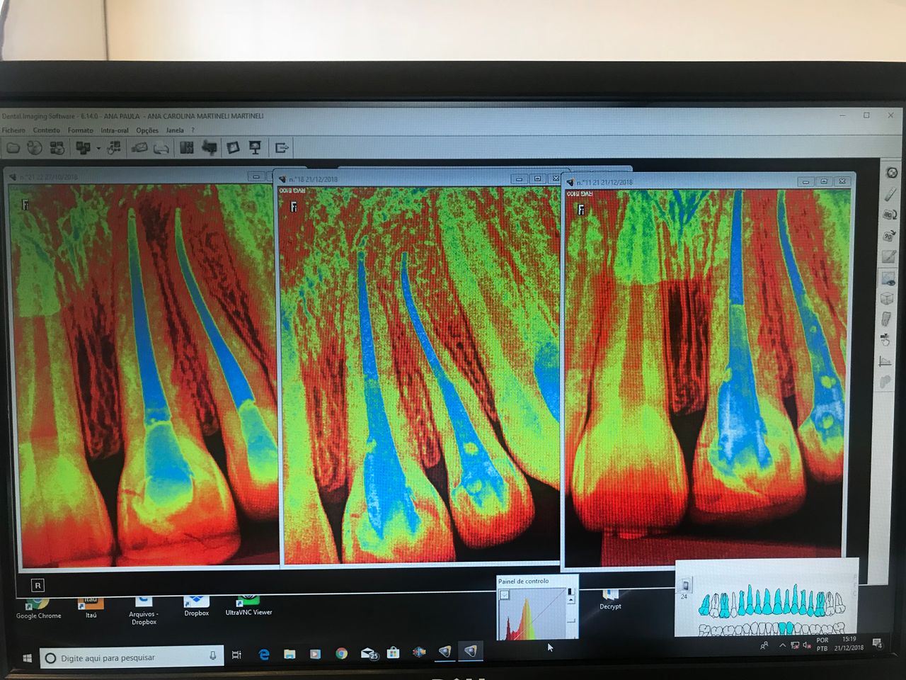 Ana Paula Minicheli Jose Martinelli-7