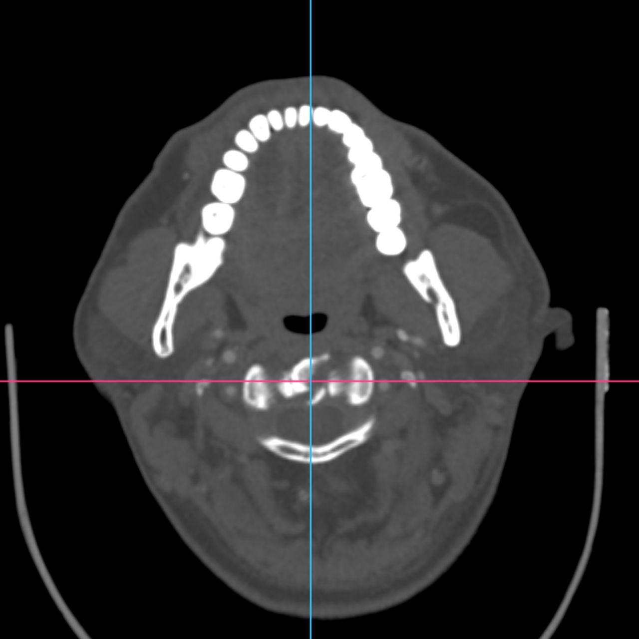 David Tafur Muñoz-2229