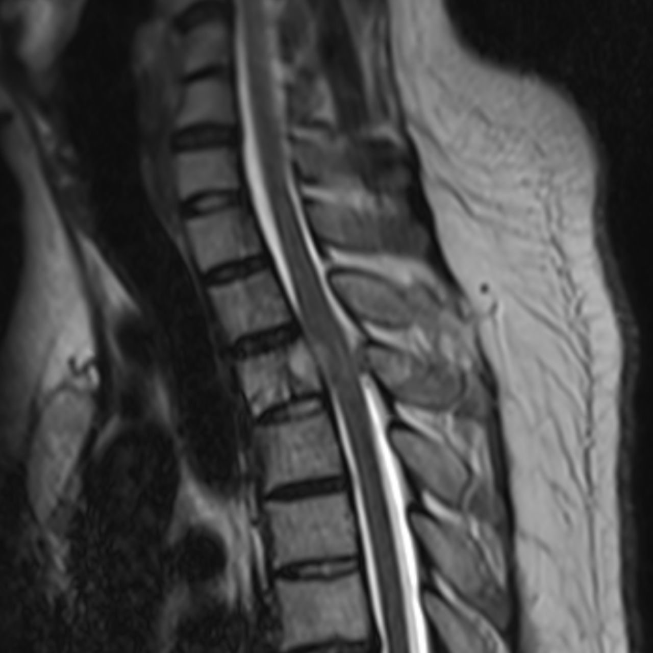 David Tafur Muñoz-2495