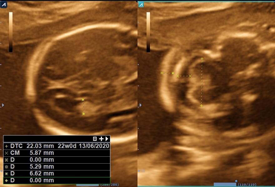 Benjamín Villarroel Castillo-13