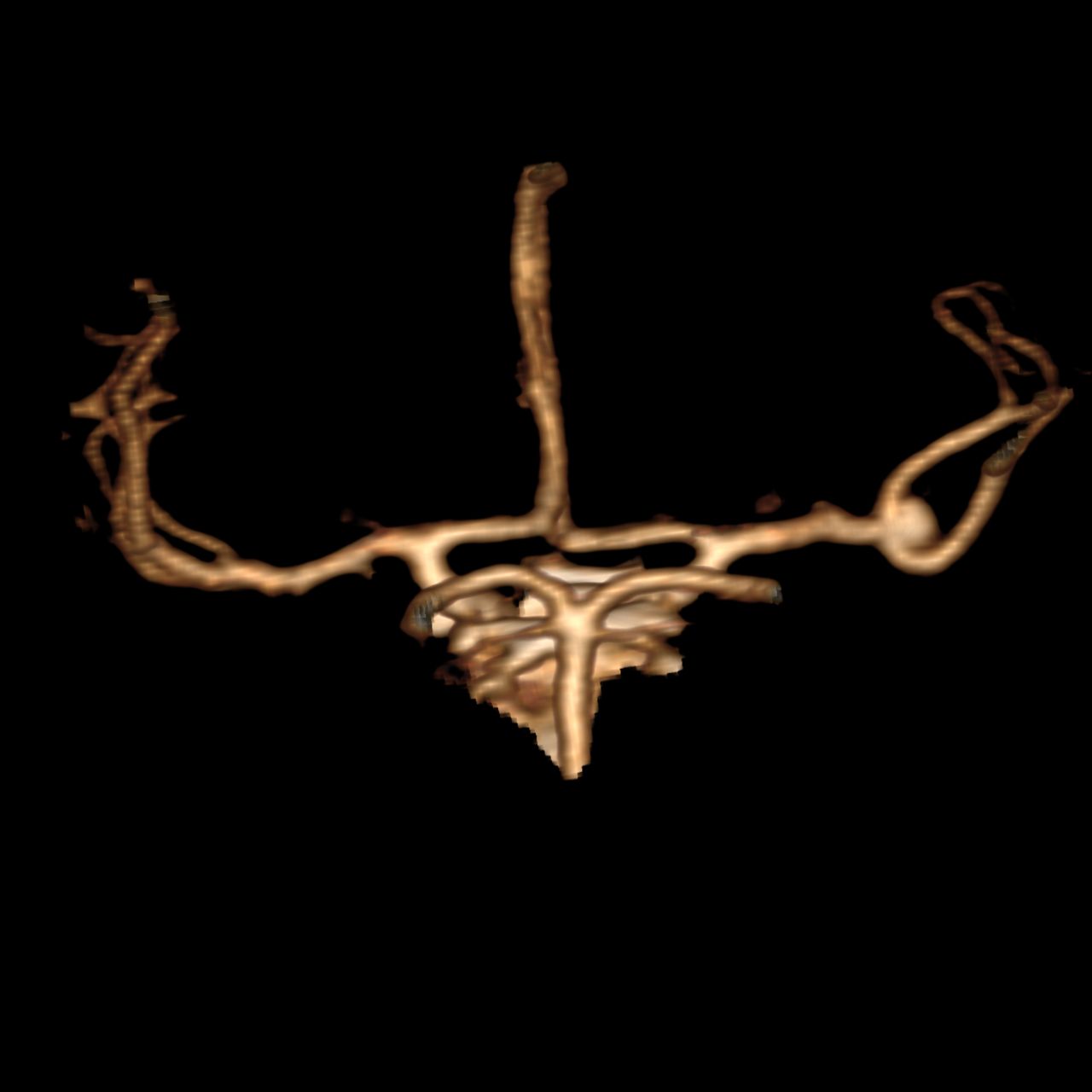 David Tafur Muñoz-2237