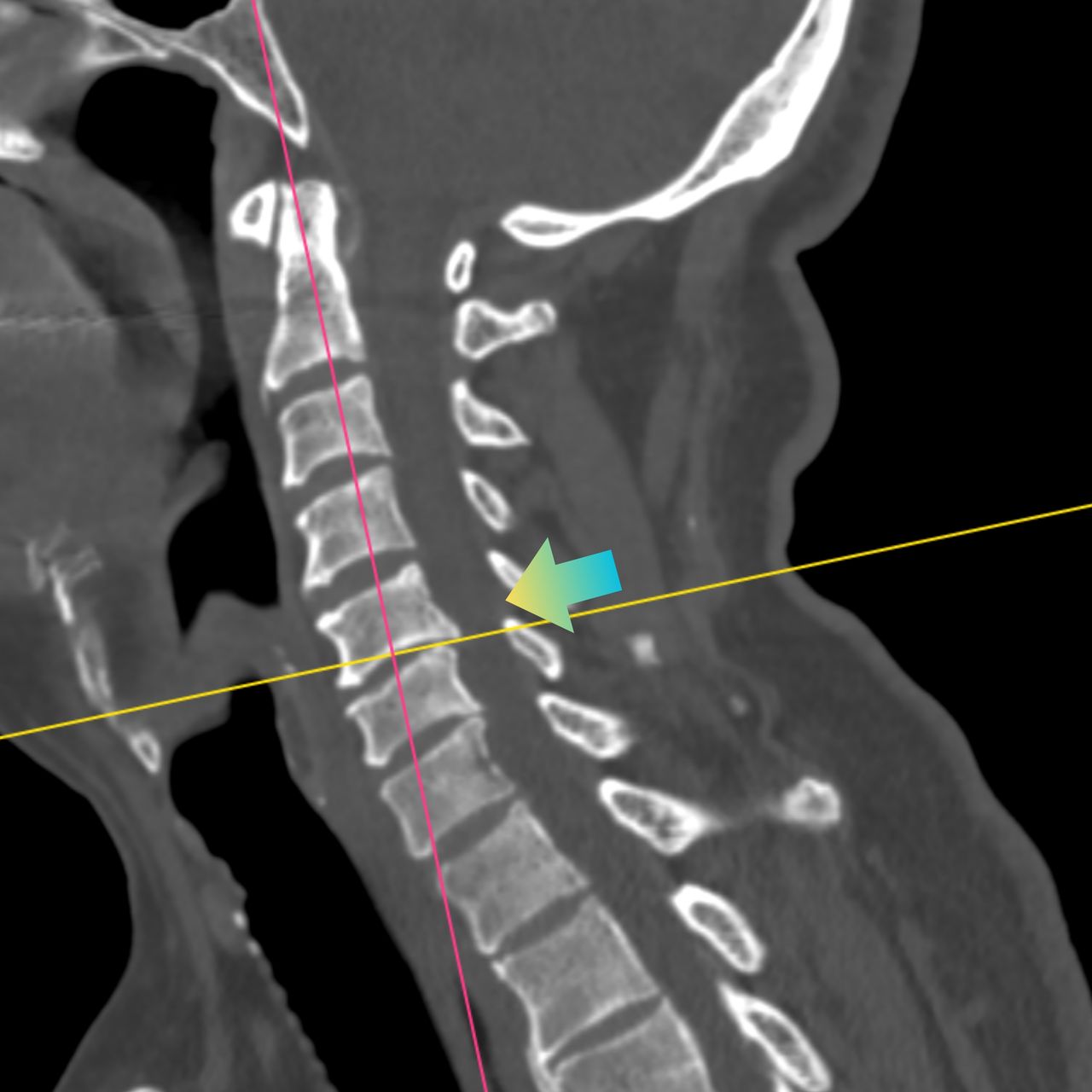 David Tafur Muñoz-2442