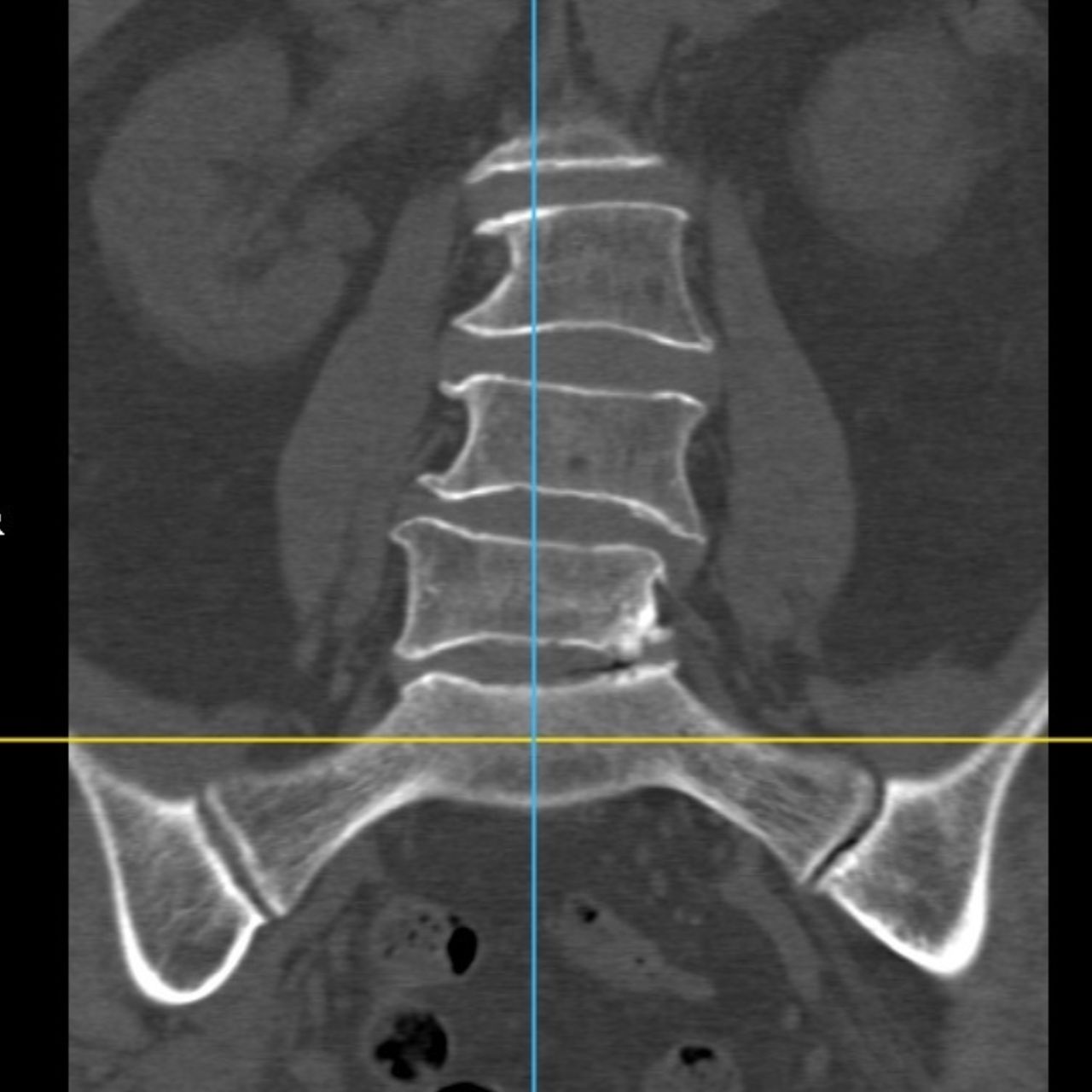 David Tafur Muñoz-1508