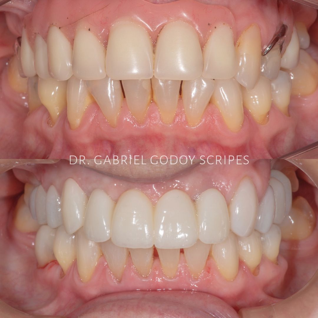 Gabriel Godoy Scripes-12