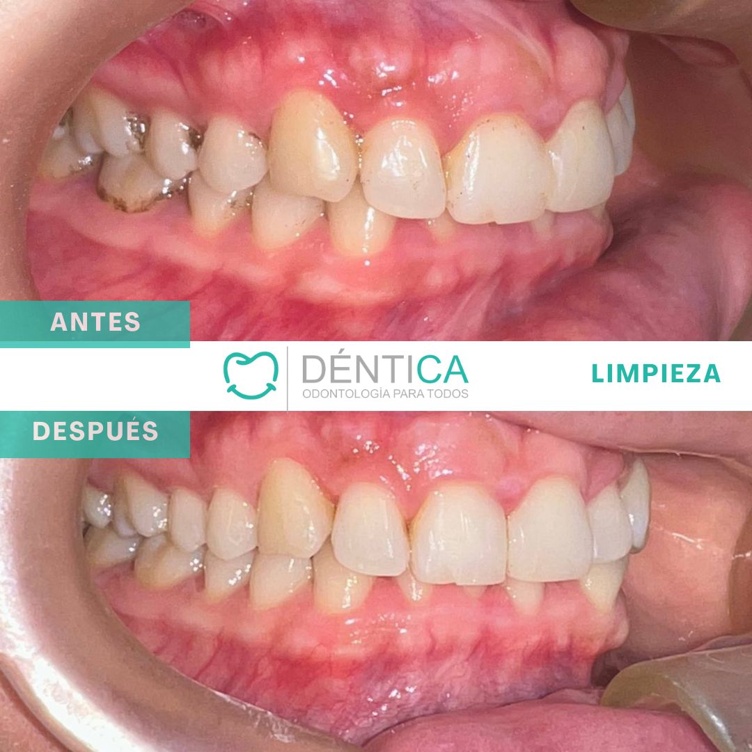 Estefani Canches Caballero-13