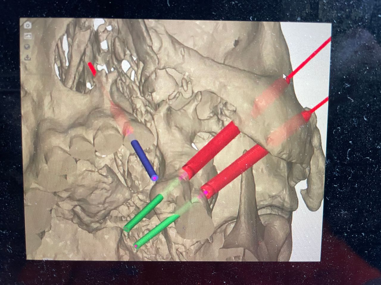 Jose Vicente Rocha Fernandez-43