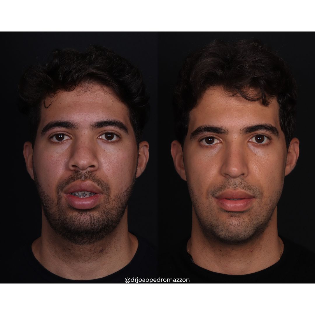 João Pedro Paulino Mazzon-42