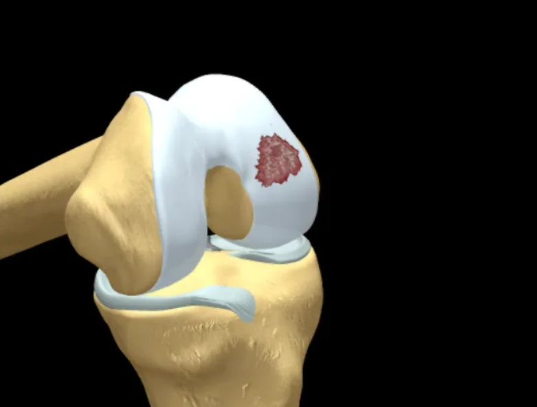 Alexandra Aranguren Medina-5