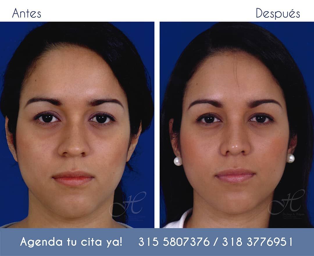 Jorge A Holguin Ruiz-42