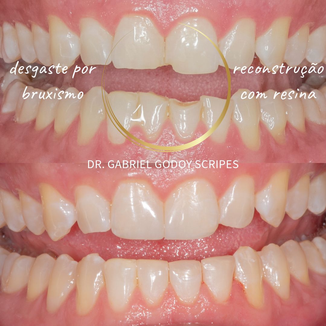 Gabriel Godoy Scripes-8