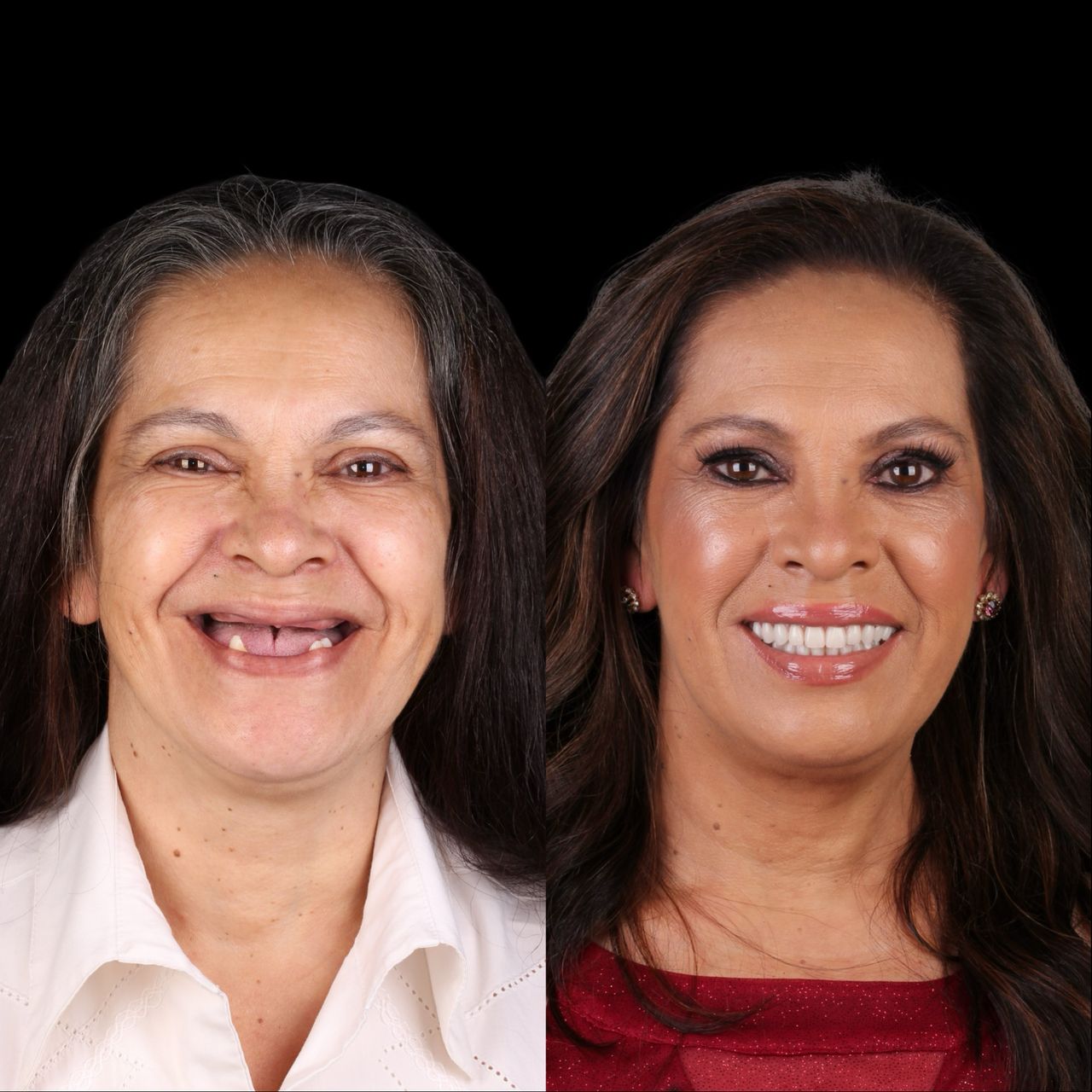 Caroline Benedeti-43