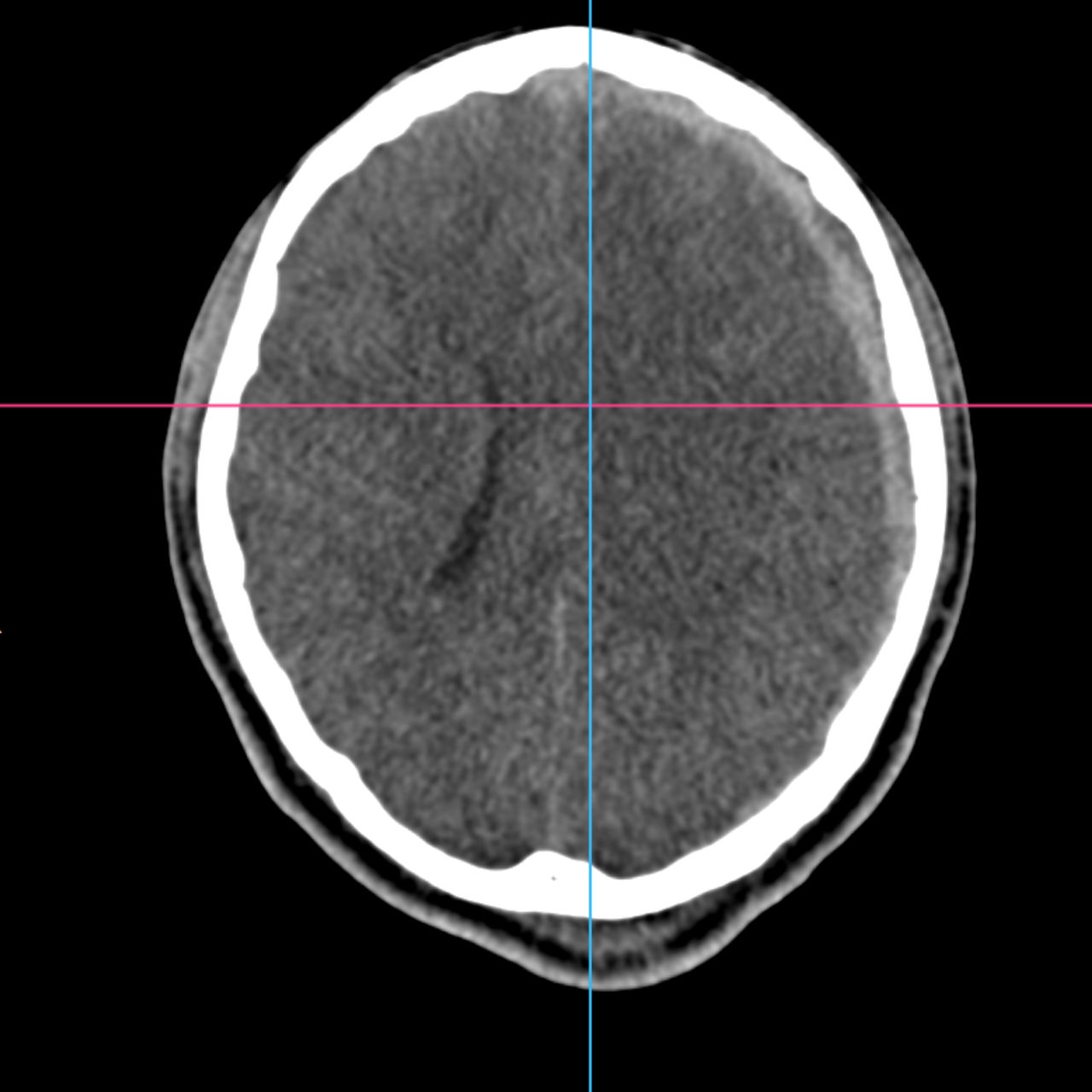 David Tafur Muñoz-2098