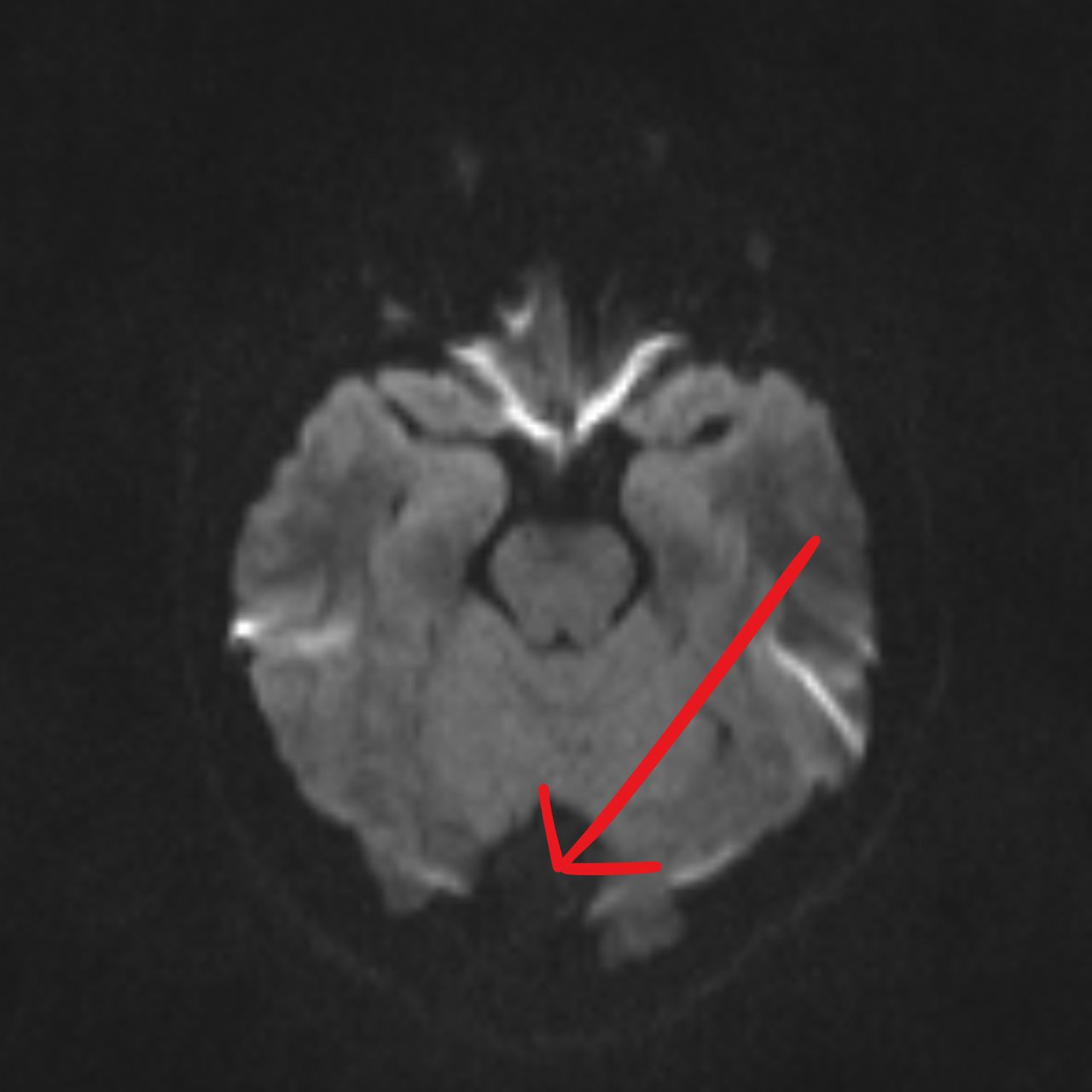 David Tafur Muñoz-2210