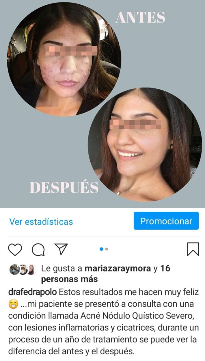 Fedra Polo Garcia-12