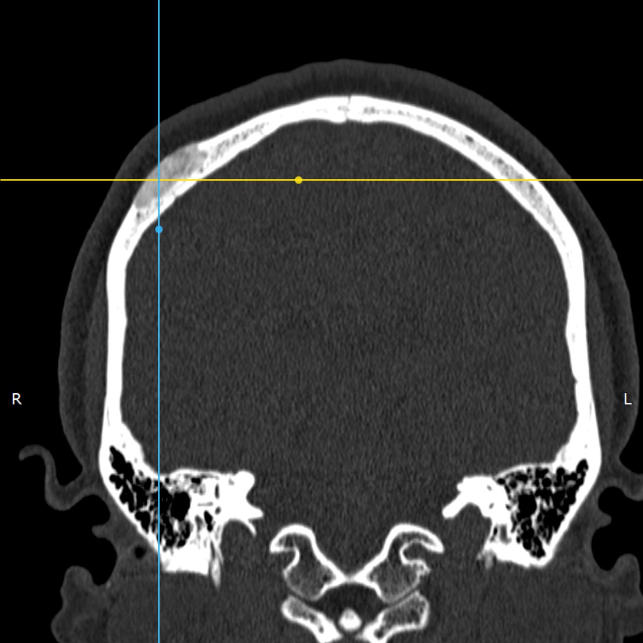 David Tafur Muñoz-2279