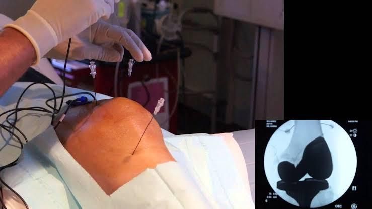 Victor Fontes Pacheco-10