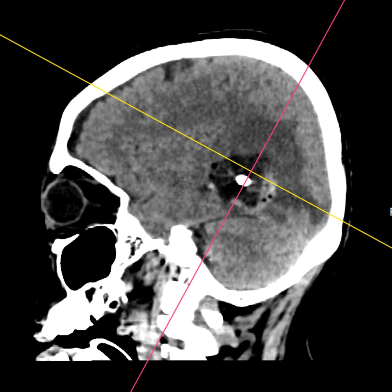 David Tafur Muñoz-1935