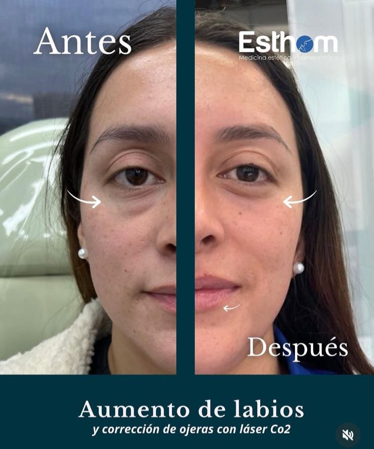 Juan Sebastian David Barinas-2