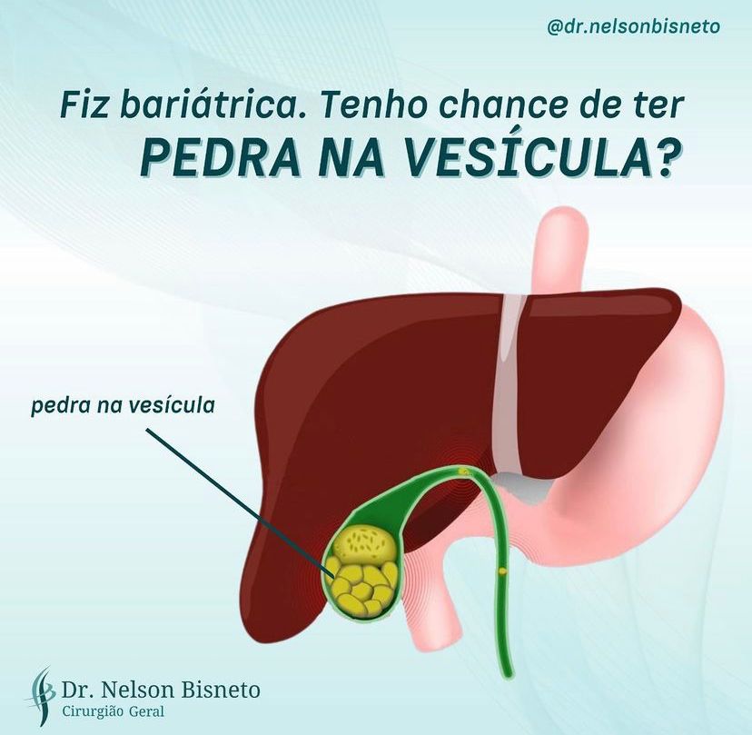 Nelson Bisneto-47