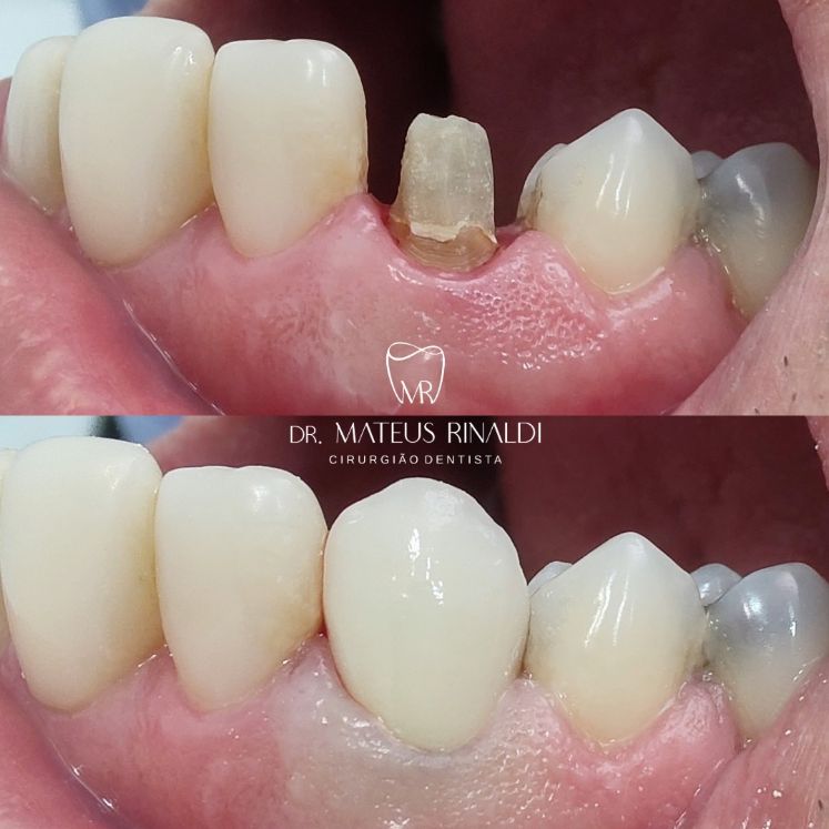 Mateus Rinaldi Lucio Martins-3