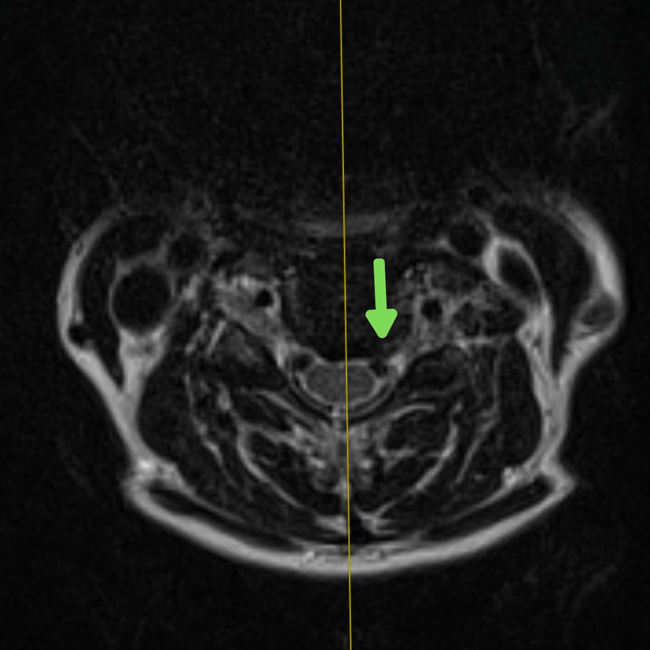 David Tafur Muñoz-2257