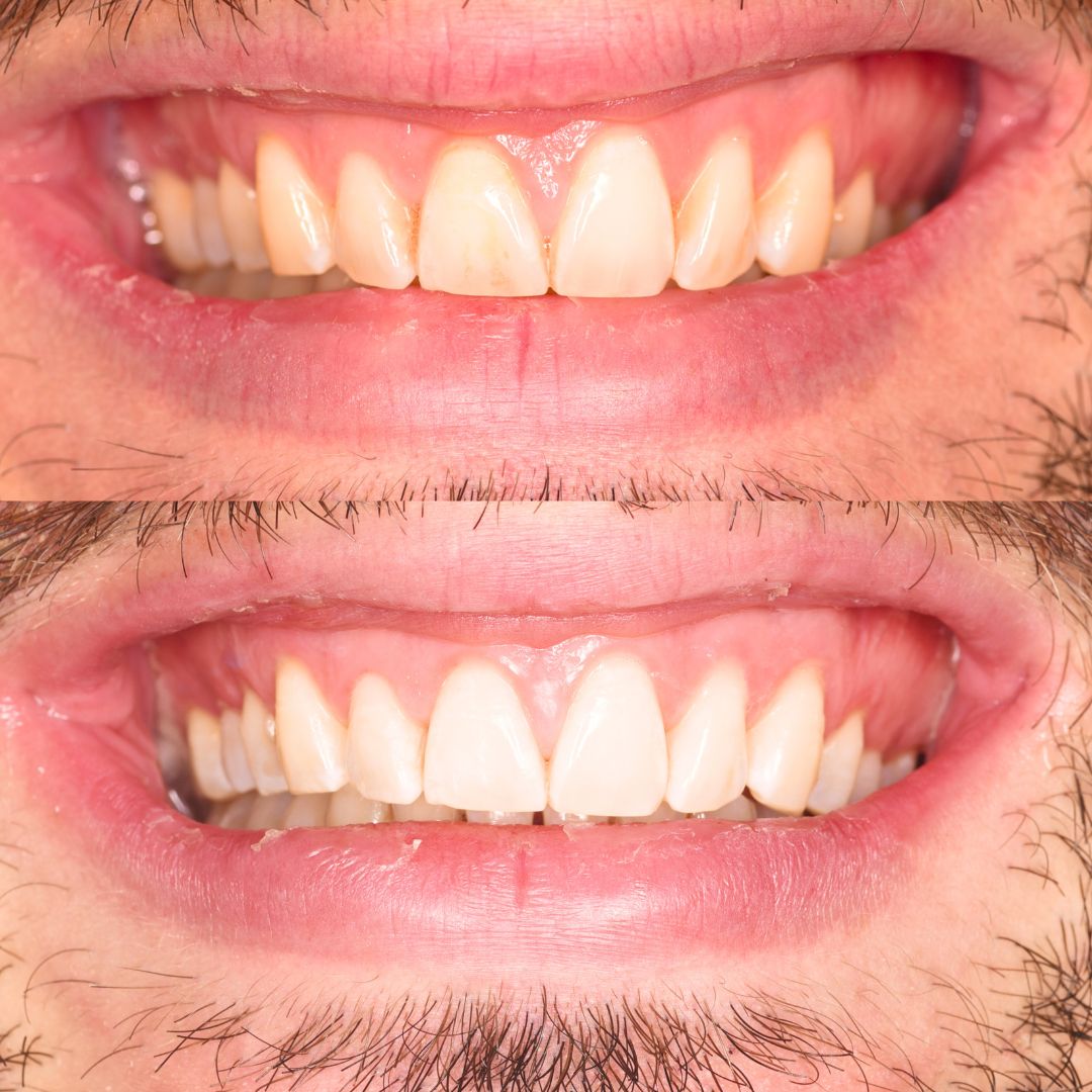 Andrés Verdugo Bolumburu-2