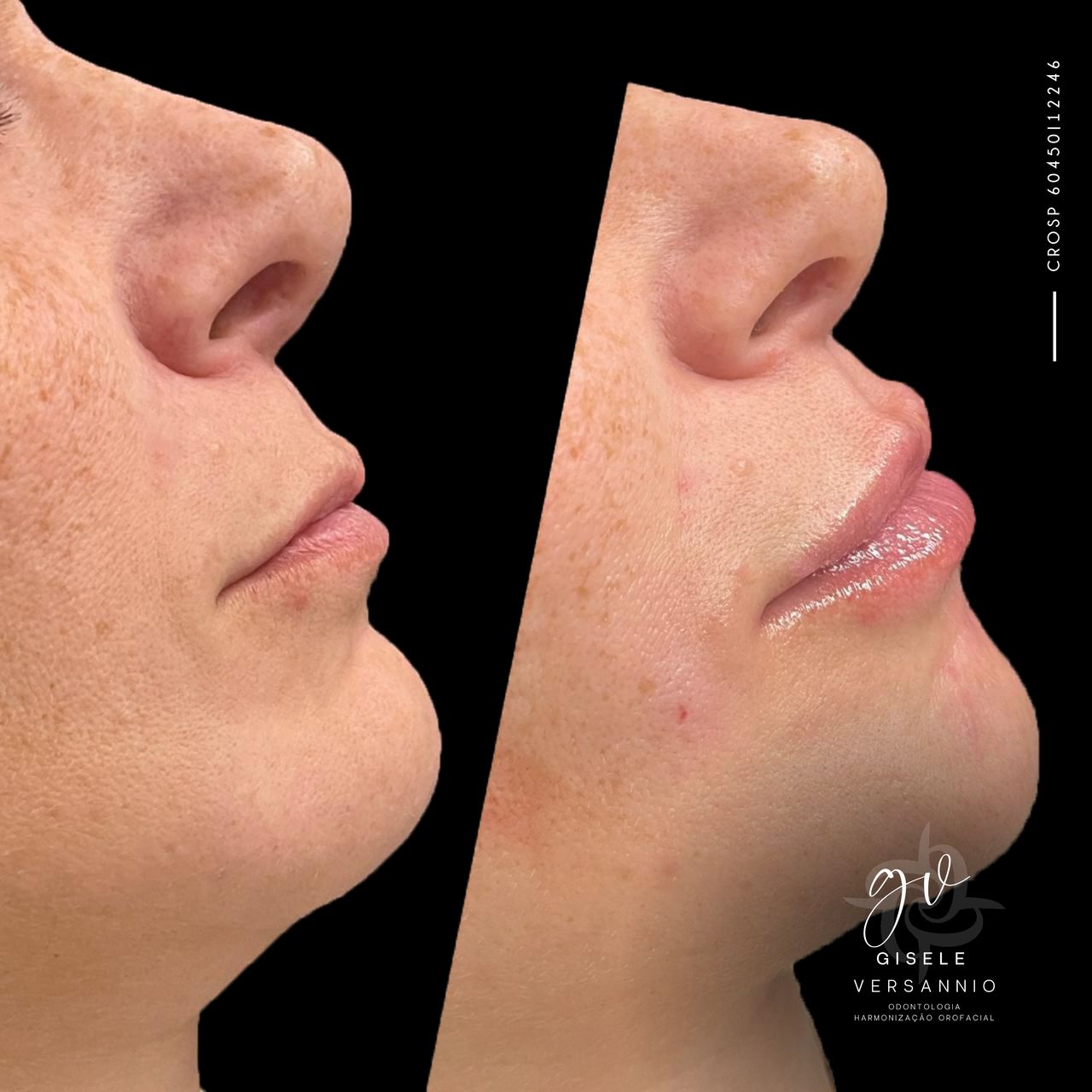 Gisele De Carvalho Versannio-29