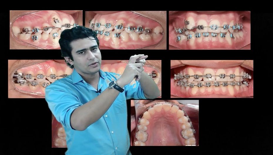 Antônio Augusto Lima De Almeida-9