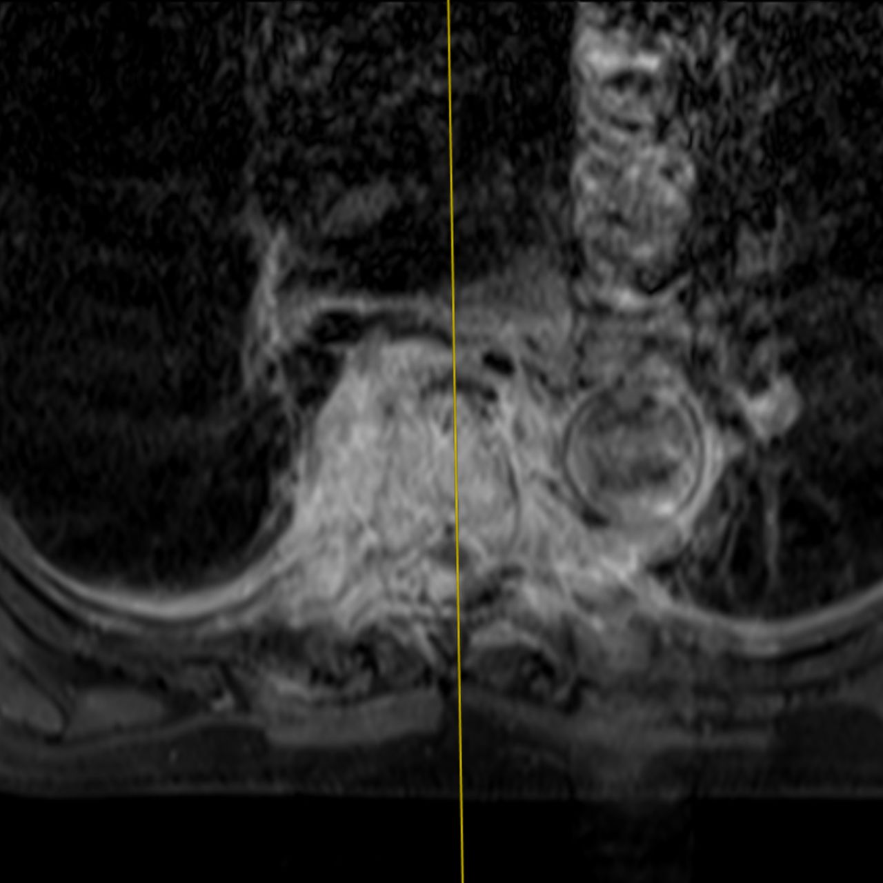 David Tafur Muñoz-1656