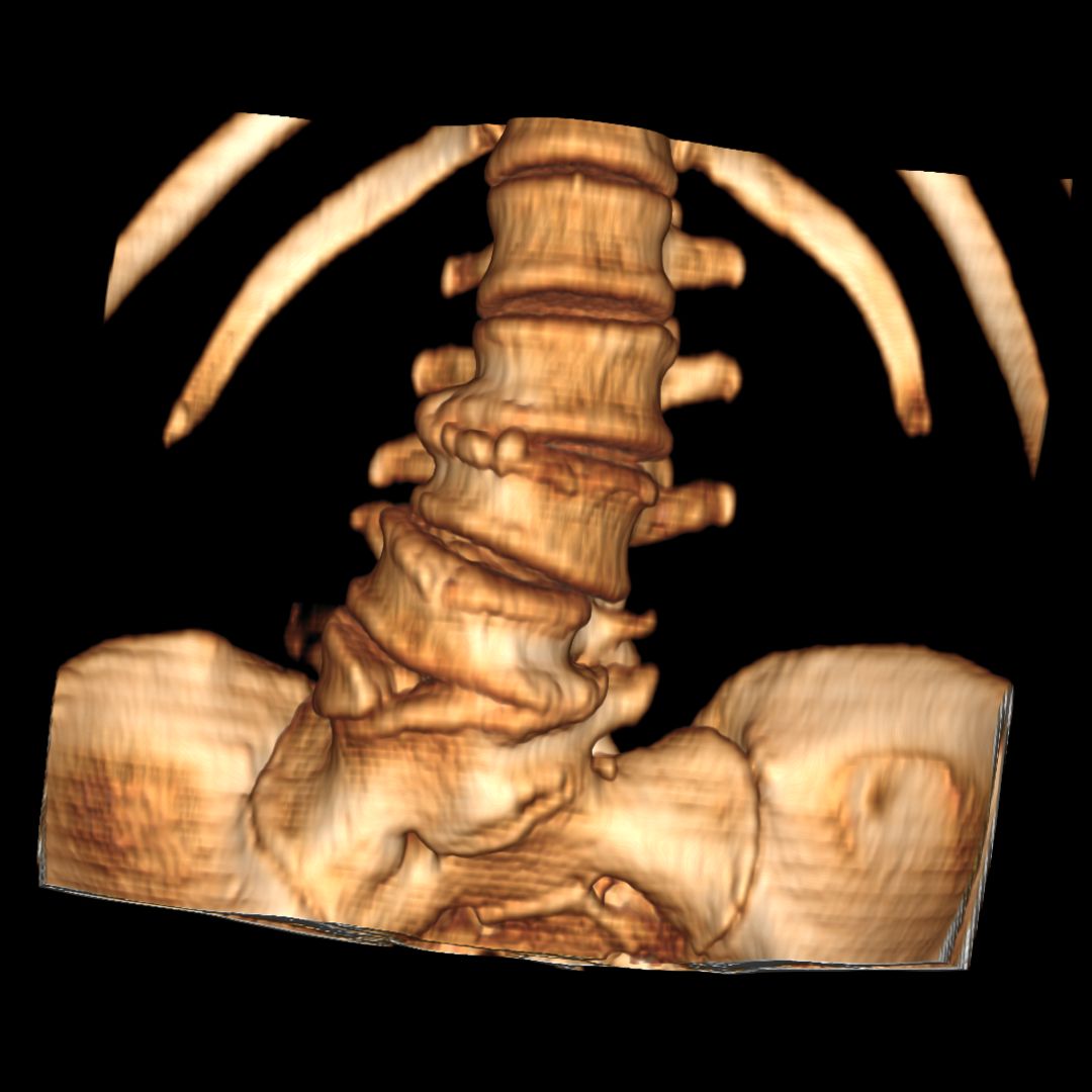 David Tafur Muñoz-2292