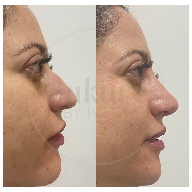 Oscar Iván Lozano Navarrete-6