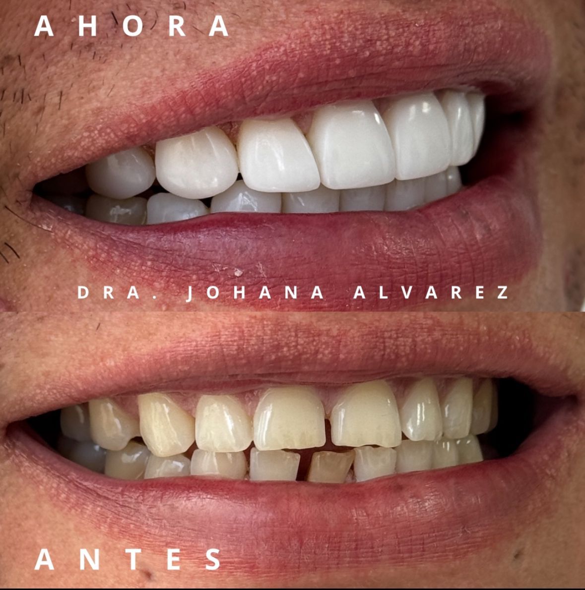 Johana Alvarez Castaño-6