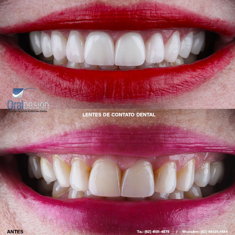 Danilo Monteiro Rezende Pereira-0