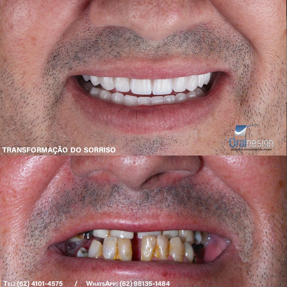 Danilo Monteiro Rezende Pereira-1