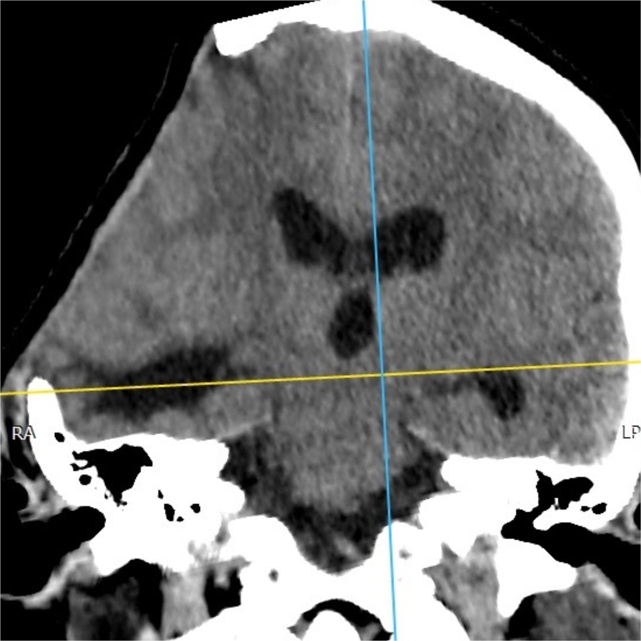 David Tafur Muñoz-1425