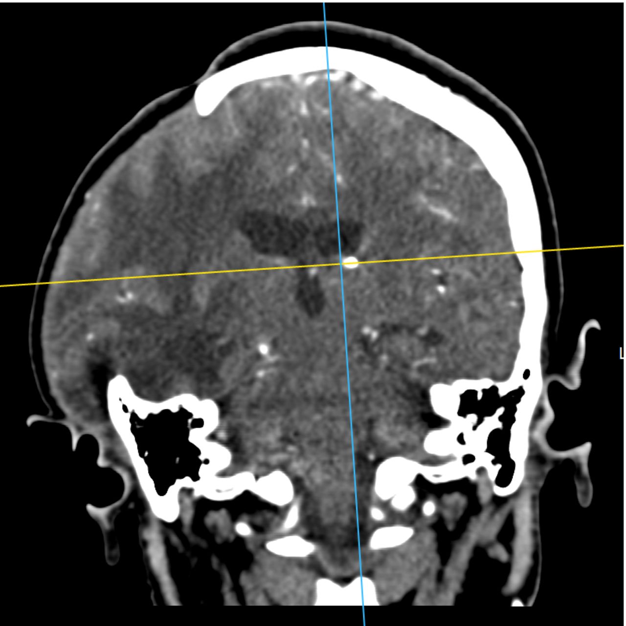 David Tafur Muñoz-1800