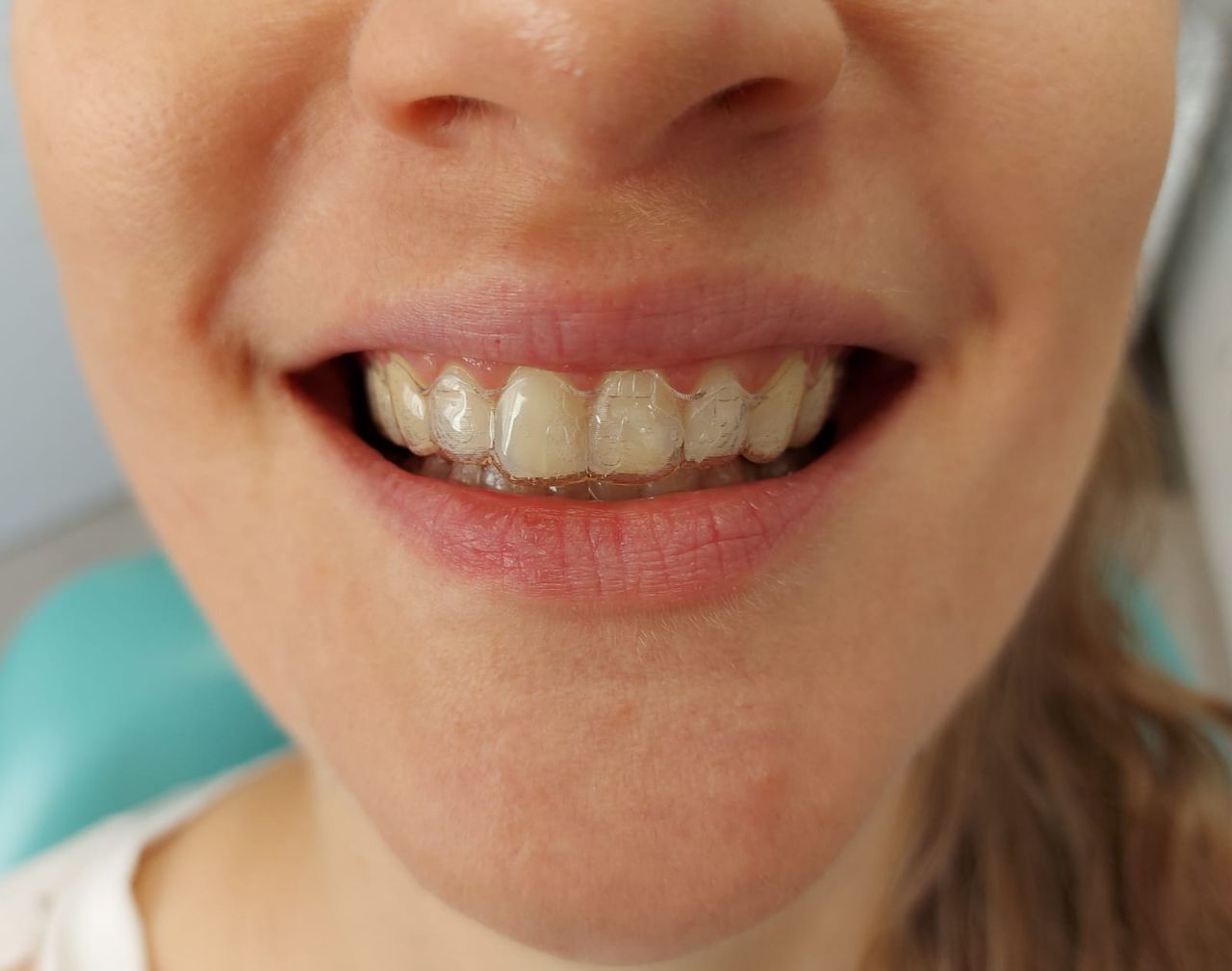 Camila De Loyola E Silva Avellar Fonseca-8